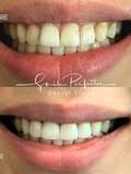 Smile Perfector Dental Group