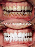 Artour Khachatrian DDS