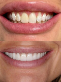 Cedar Smiles Dentistry