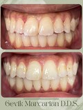 Gevik Marcarian DDS