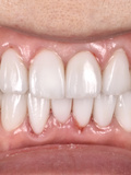 Bliss Dental