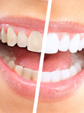 Santa Rosa Dental