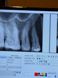Soft Touch Endodontics