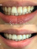 Smile Perfector Dental Group
